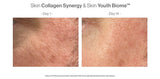 ANP - Collagen Synergy