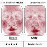 ANP - Skin Blue Light Filter
